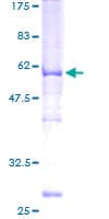 Human ABHD10 Protein (Recombinant GST)