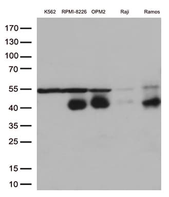 Monoclonal Mouse anti-Human CD38 Antibody (clone OTI1C9, aa43-300, IHC, WB)