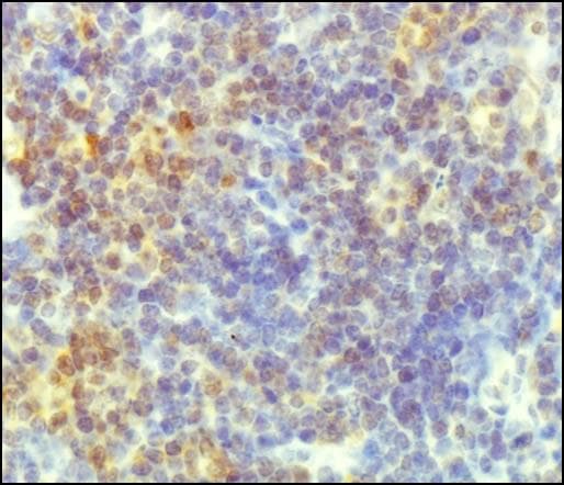 CRTC2 / TORC2 Antibody (aa600-693)