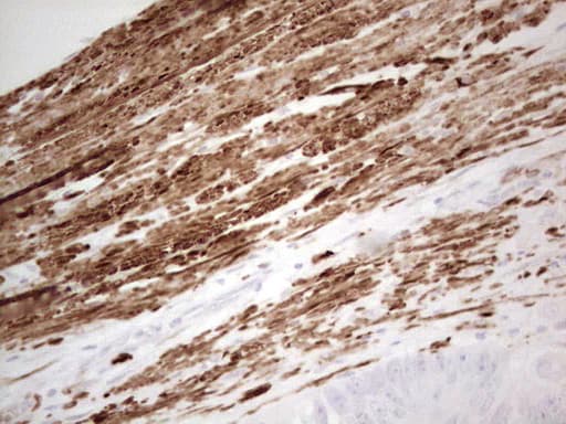 Monoclonal Mouse anti-Human DMN / Desmuslin / Synemin Antibody (clone 2F4, Carrier-free, aa329-580, IHC)
