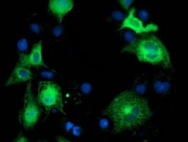 Monoclonal Mouse anti-Human BECN1 / Beclin-1 Antibody (clone OTI2C5, IF, WB)