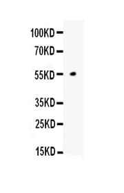 Polyclonal Rabbit anti-Human ANGPTL4 Antibody (WB)