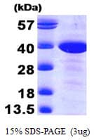 Human MAT2B Protein (Recombinant)