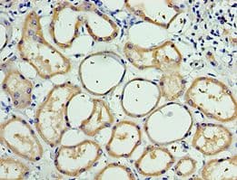 CDH6 / K Cadherin Antibody (aa1-250)
