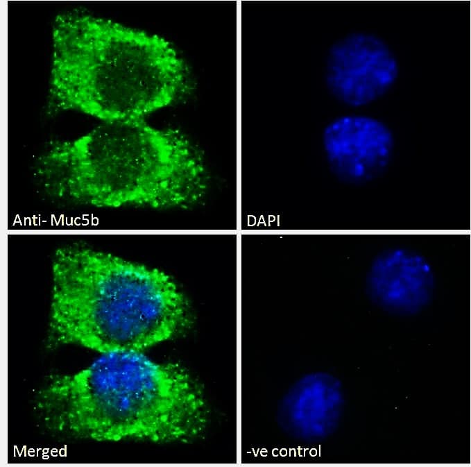 MUC5B Antibody (aa4756-4766)