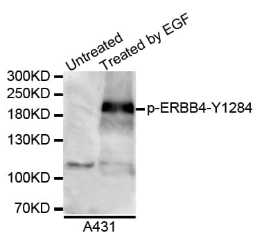 ERBB4 / HER4 Antibody (phospho-Tyr1284)