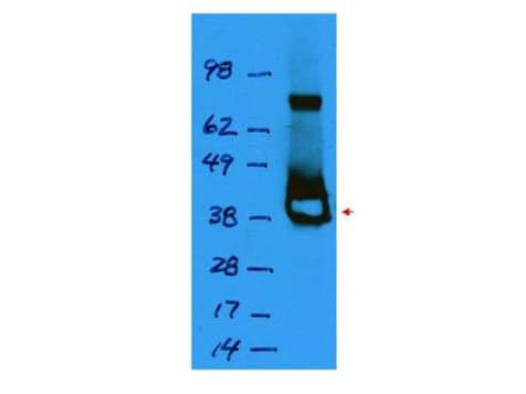 LacI / Lac Repressor Antibody