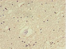E2F2 Antibody