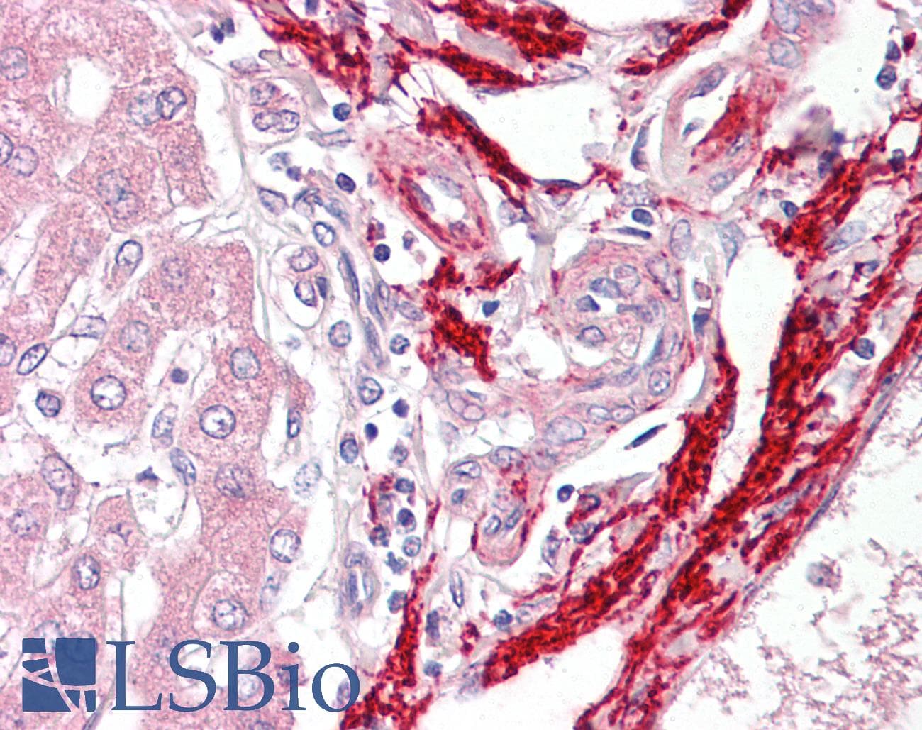 IHC-plus™ Monoclonal Mouse anti-Human VTN / Vitronectin Antibody (IHC, WB)