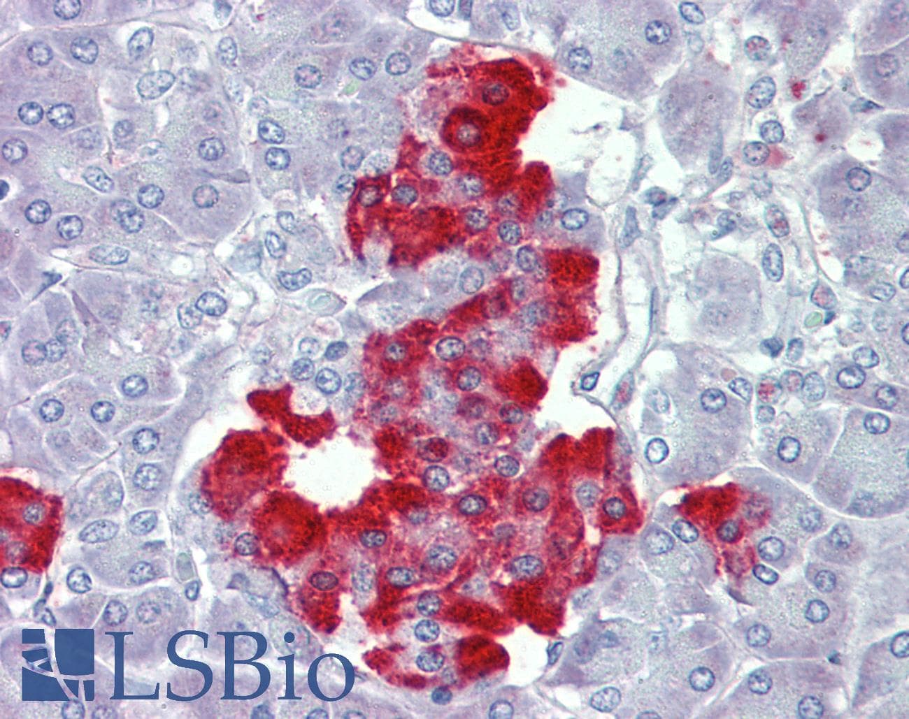 IHC-plus™ PDGF-BB Antibody (aa222-233)