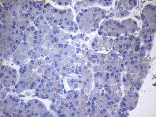 CYTH2 / Cytohesin 2 Antibody (clone OTI4D9)
