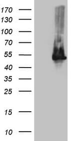 TWF1 / PTK9 Antibody (aa140-384, clone OTI1C2, Carrier-free)