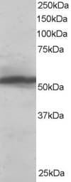 IHC-plus™ Polyclonal Goat anti-Human KPNA2 / Importin Alpha 1 Antibody (aa518-529, IHC, WB)