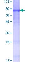 Human SIAE Protein (Recombinant GST)