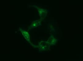 SYP / Synaptophysin Antibody (clone OTI3E2, Carrier-free)