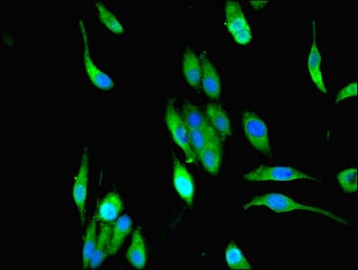 Polyclonal Rabbit anti-Human MPPED1 Antibody (IHC)