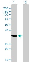 Monoclonal Mouse anti-Human ZNF215 Antibody (clone 2C11, WB)