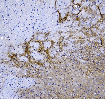 Polyclonal Rabbit anti-Human SYT1 / Synaptotagmin Antibody (IHC, WB)