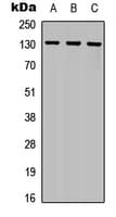 CD135 / FLT3 Antibody (Internal)