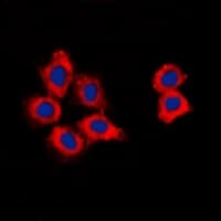 CDK15 / ALS2CR7 Antibody (Internal)