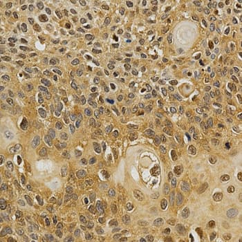 NFATC1 / NFAT2 Antibody