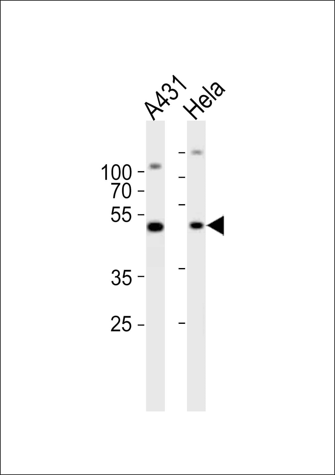 NOVA1 Antibody (aa139-173)