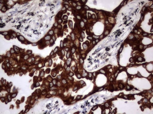 Monoclonal Rat anti-Human Acidic Cytokeratin Antibody (clone 2G10, IHC)