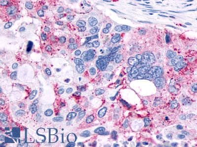 PathPlus™ Polyclonal Rabbit anti-Human MRGPRX3 / MRGX3 Antibody (Extracellular Domain, IHC)