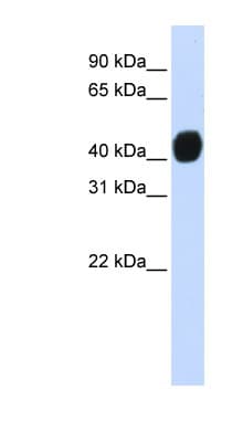 ARA55 / HIC-5 Antibody (N-Terminus)