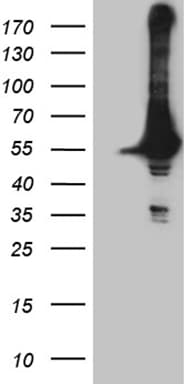 DDX19A Antibody (clone OTI3C12)