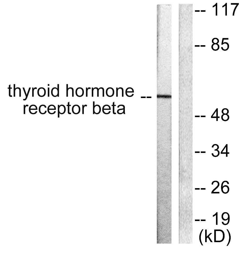 Polyclonal Rabbit anti-Human NR1A2 / THRB Antibody (IHC, WB)