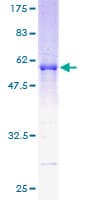 Human RDH11 Protein (Recombinant GST)