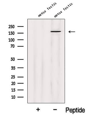 Polyclonal Rabbit anti-Human SSFA2 Antibody (IF, WB)