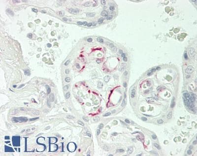 IHC-plus™ Polyclonal Rabbit anti-Human CACNA1E / Cav2.3 Antibody (Internal, IHC, WB)