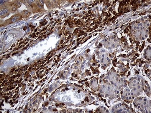 Monoclonal Mouse anti-Human SH3BP1 Antibody (clone OTI3G1, Carrier-free, IHC, WB)
