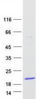 Human TCL1B Protein (Recombinant Myc-DDK (Flag))