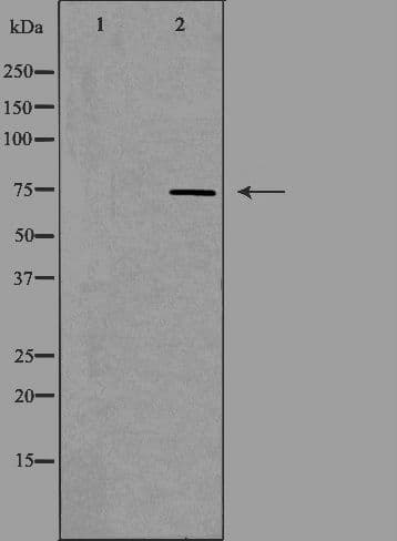 Polyclonal Rabbit anti-Human ADD3 Antibody (IF, WB)