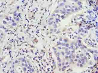 ZNF643 Antibody
