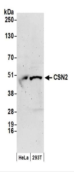 IHC-plus™ Polyclonal Rabbit anti-Human COPS2 / TRIP15 / ALIEN Antibody (aa1-50, IHC, WB)