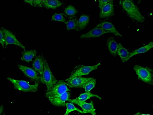 Polyclonal Rabbit anti-Human CAMK1 / CAMKI Antibody (IF, WB)