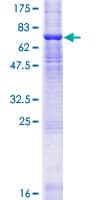 Human ZDHHC11 Protein (Recombinant GST)