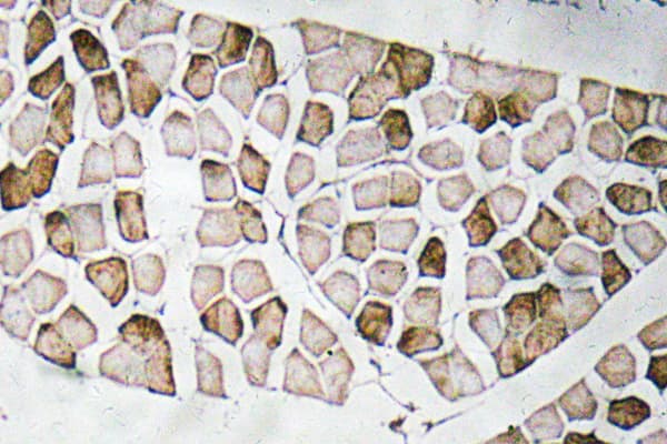 Polyclonal Rabbit anti-Human RTN4 / Nogo Antibody (Glu499, IHC, WB)