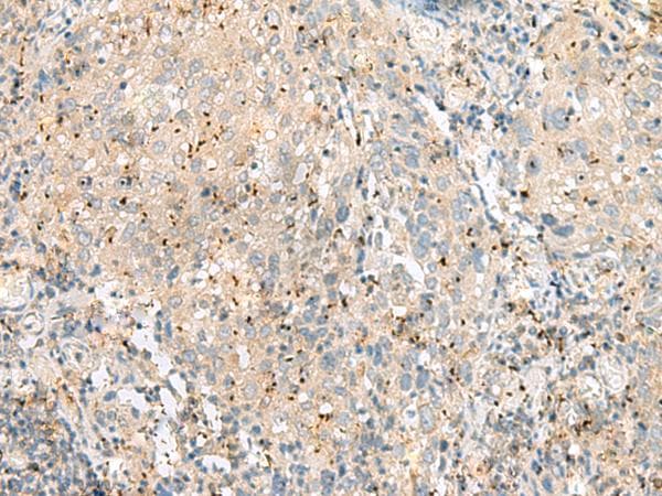 EIF3L / EIF3EIP Antibody