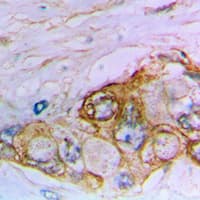 MUC16 / CA125 Antibody (Internal)