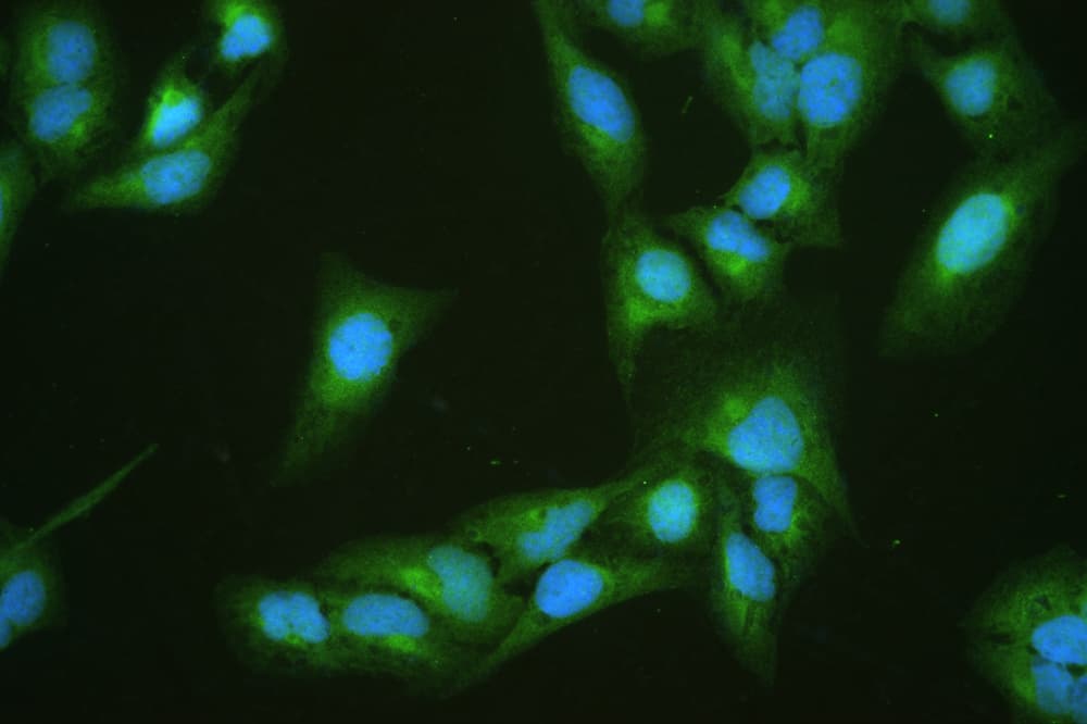 DBI / ACBD1 Antibody
