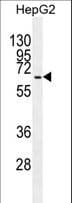 Polyclonal Rabbit anti-Human GAD1 / GAD67 Antibody (aa514-543, WB)