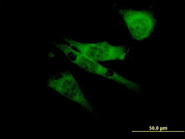 SCN8A / Nav1.6 Antibody (clone 4G7)
