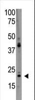 PDAP1 Antibody (aa142-171)