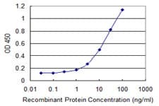 TDP2 / TTRAP Antibody (clone 3D11)