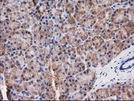 DSTN / Destrin Antibody (clone OTI2F7)